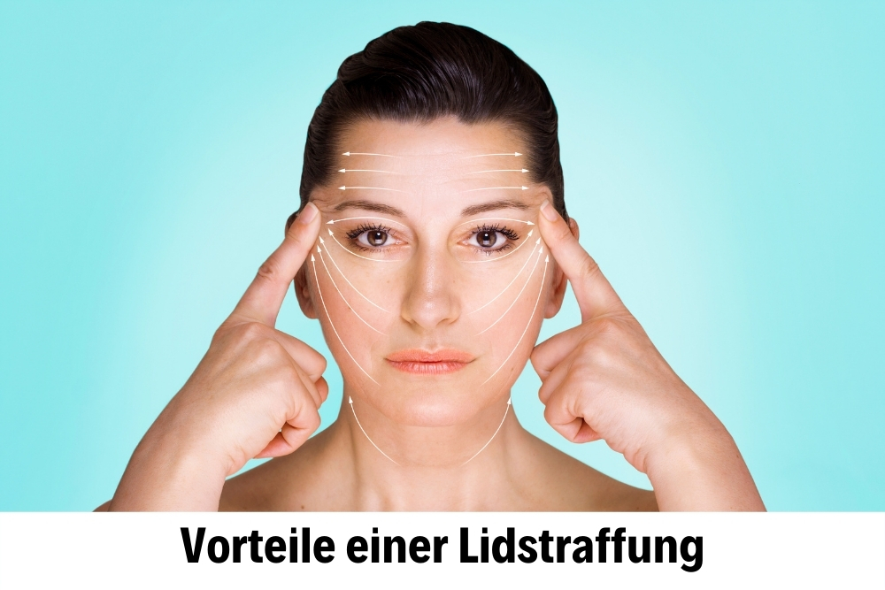 Lidstraffung 