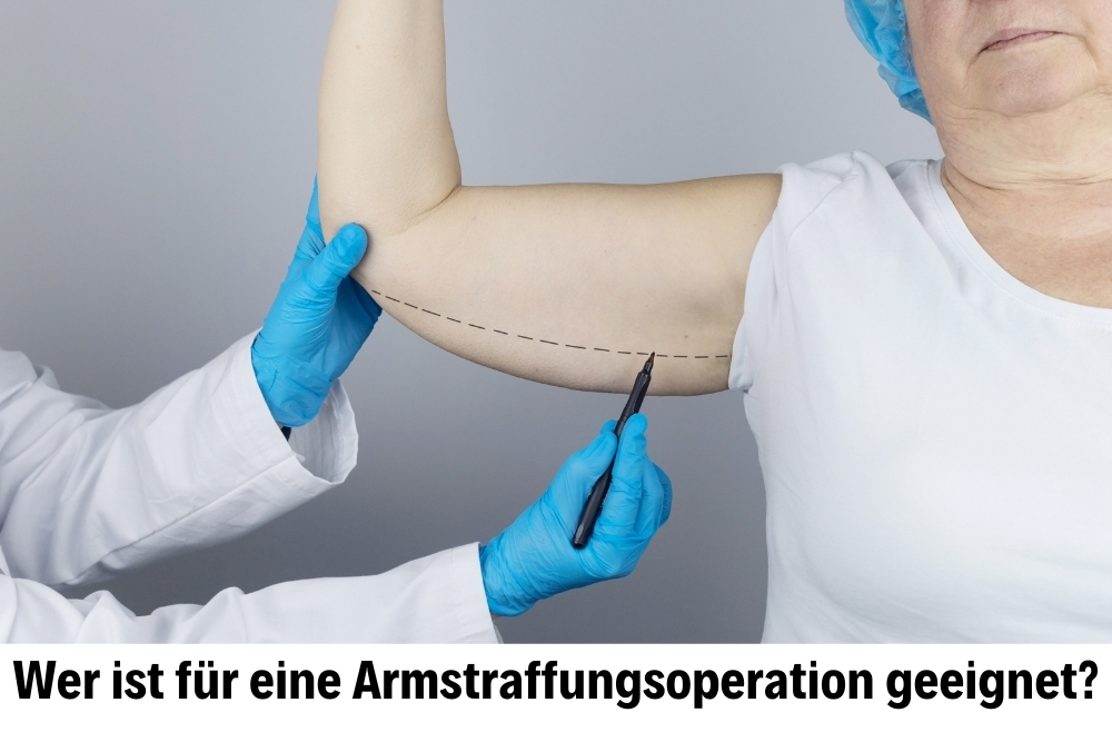 Armstraffungsoperation (Brachioplastie)