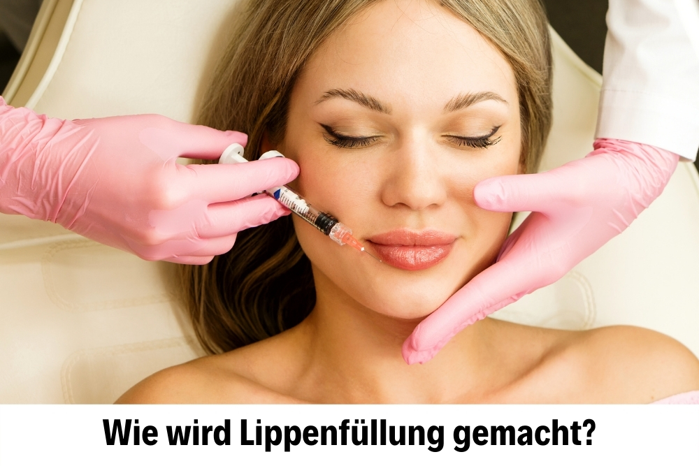 Lippenfüllung