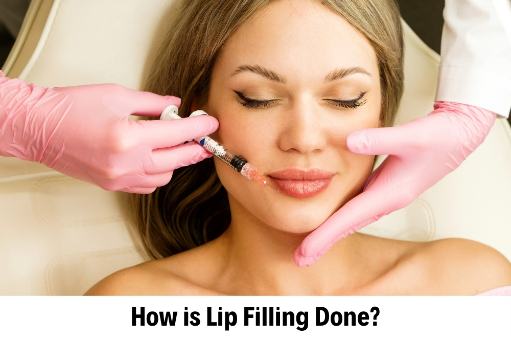 Lip Filling