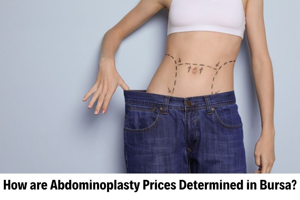 Abdominoplasty