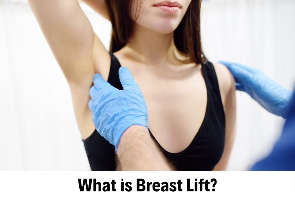  Breast Lift 