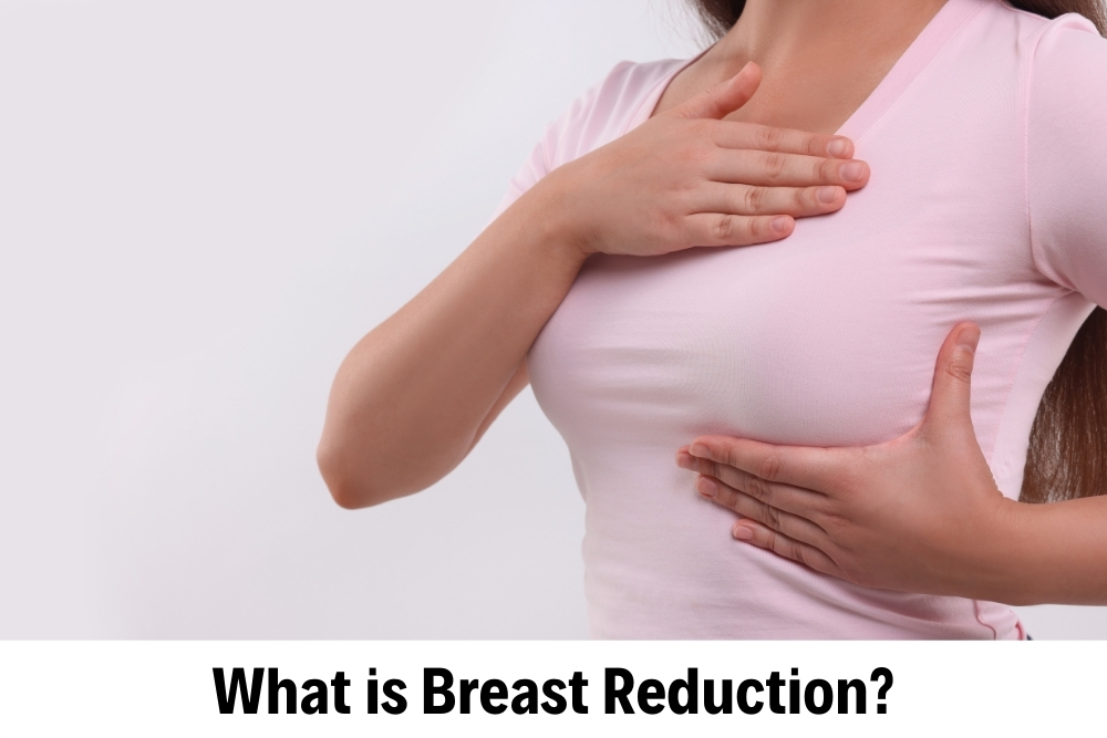 Breast Reduction 