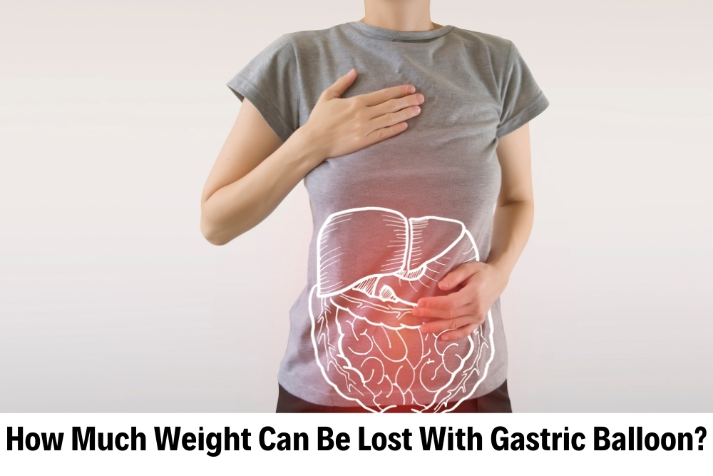 Gastric Balloon