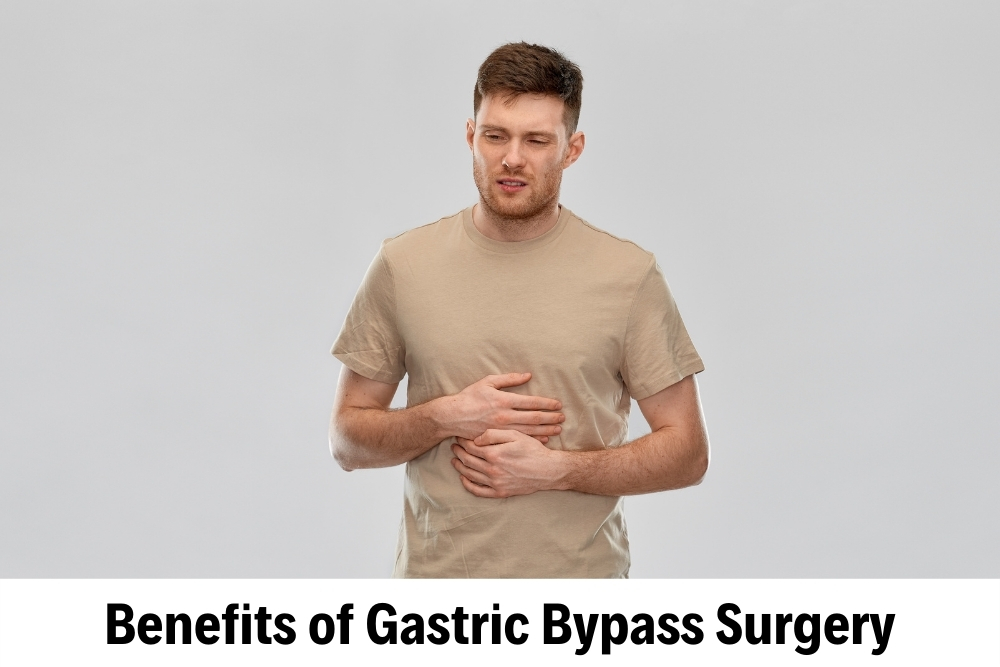  Stomach Bypass 