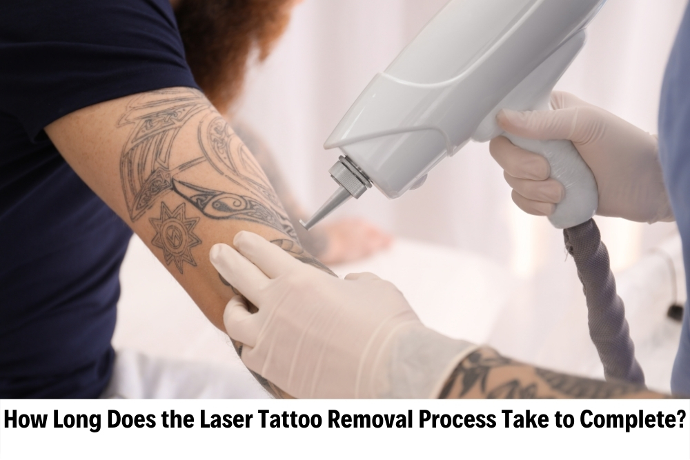 Laser Tattoo Removal