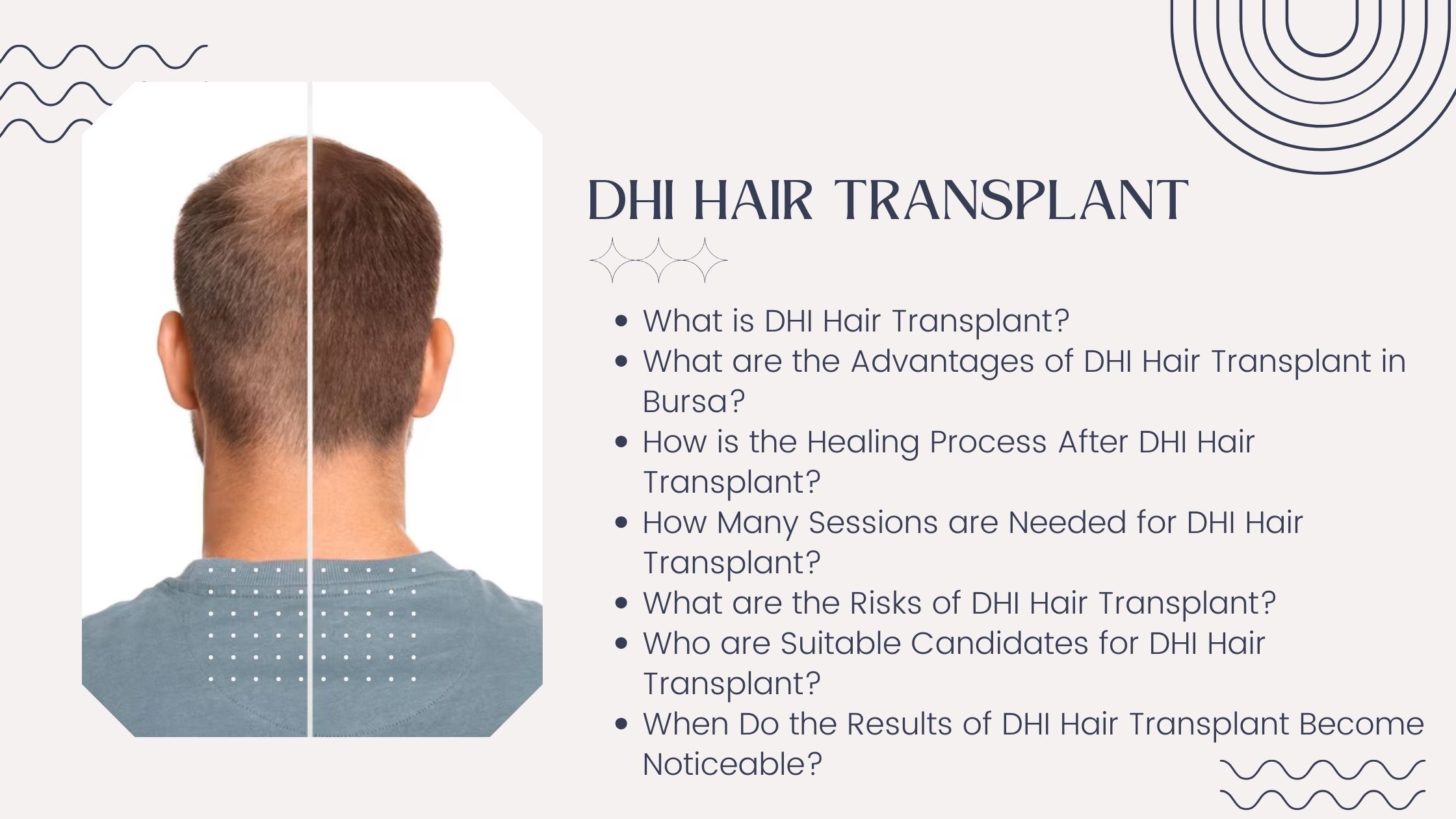 DHI Hair Transplant