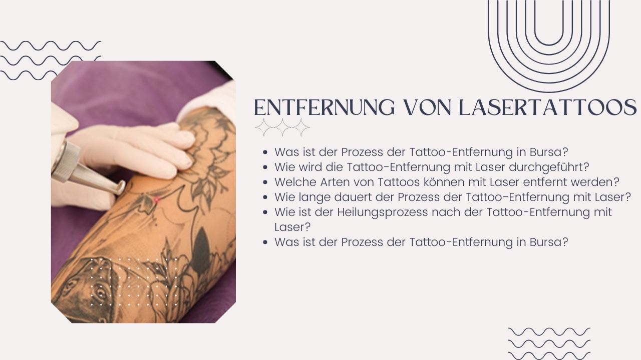 Laser Tattoo Entfernung