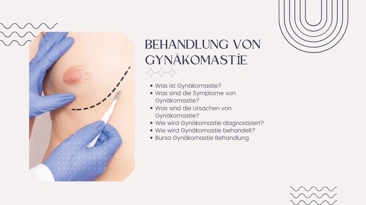 Behandlung von Gynäkomastie