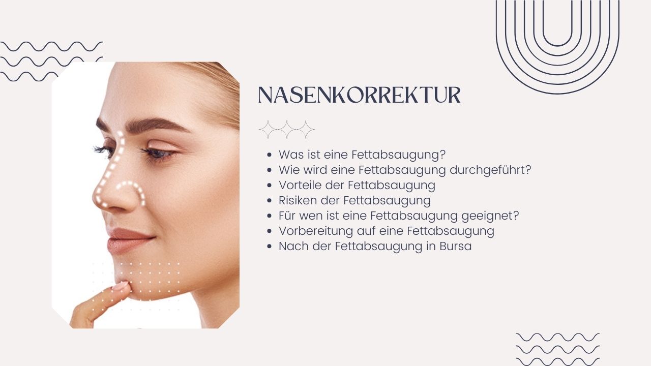 Rhinoplastik