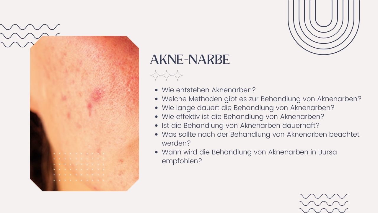 Akne-Narbe