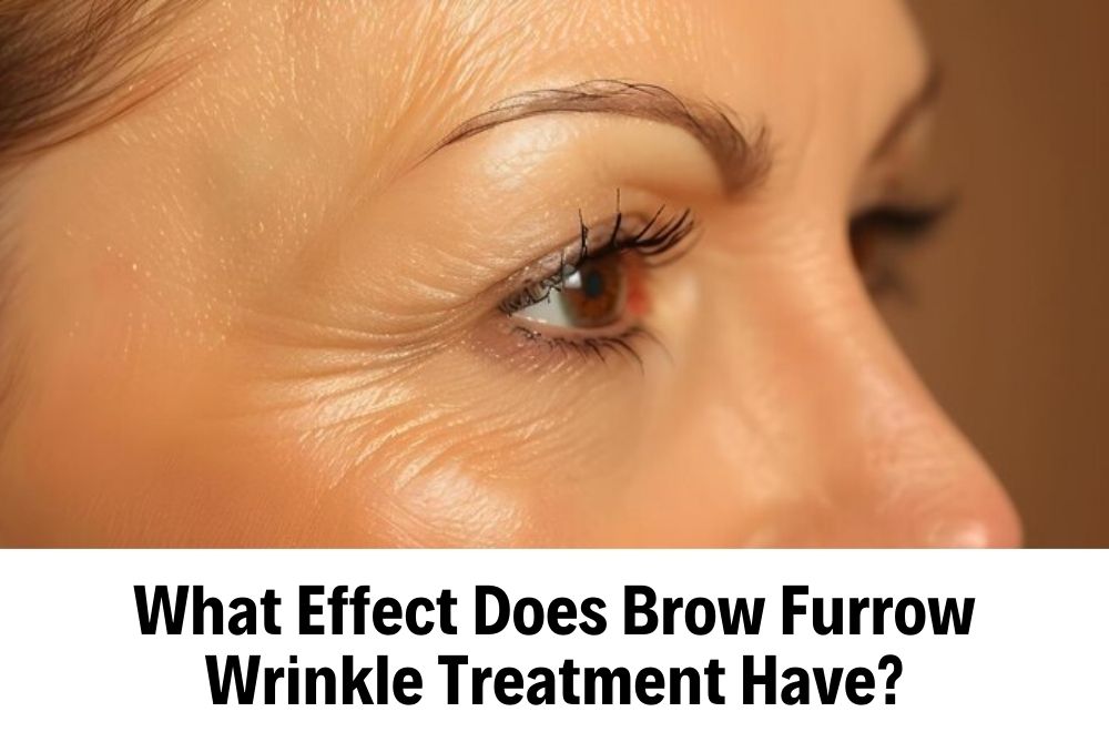 Brow Furrow Wrinkle - Unisahealth