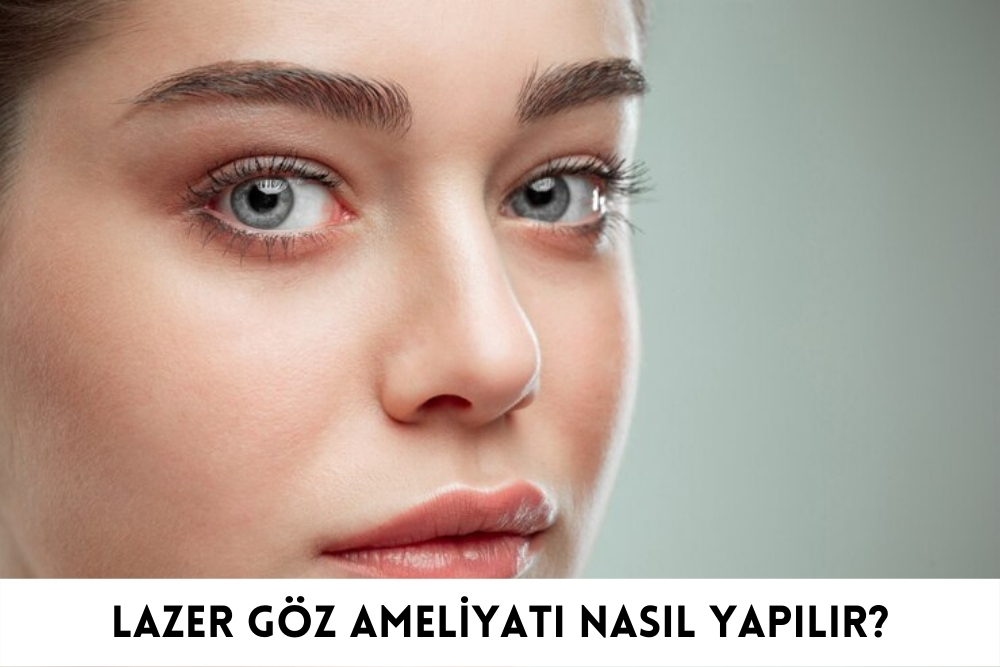 Lazer Göz Ameliyatı