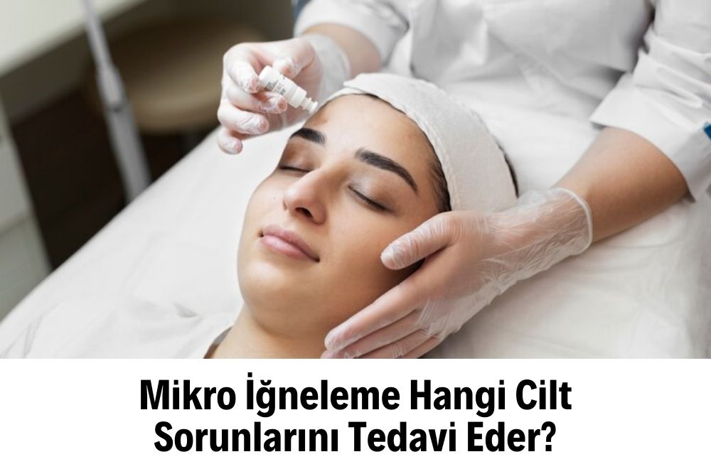 Mikro İğneleme