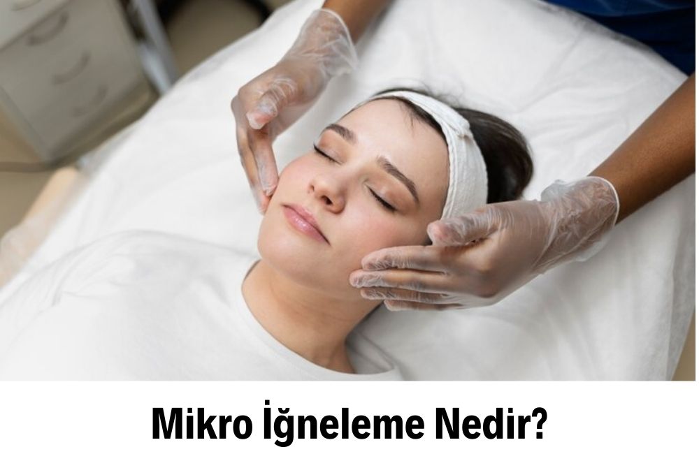 Mikro İğneleme