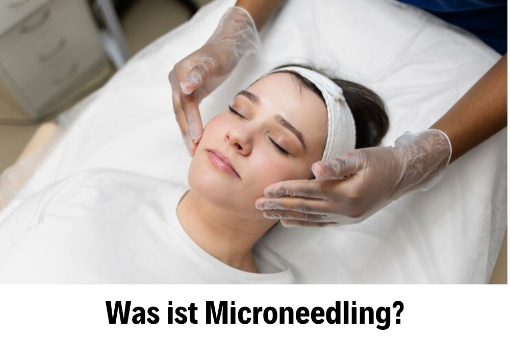 Microneedling 