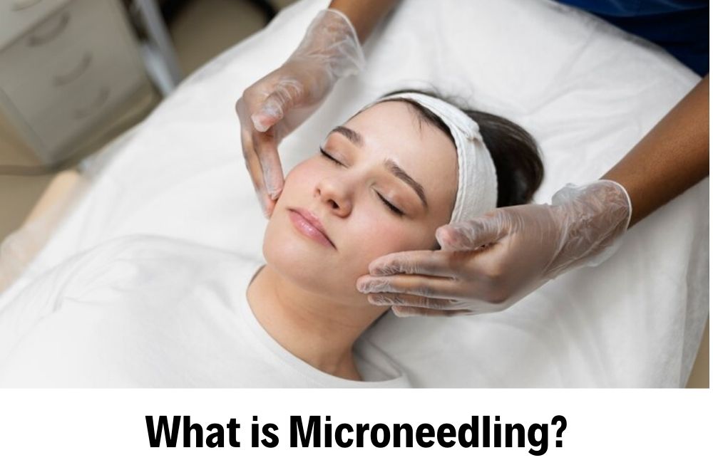 Microneedling