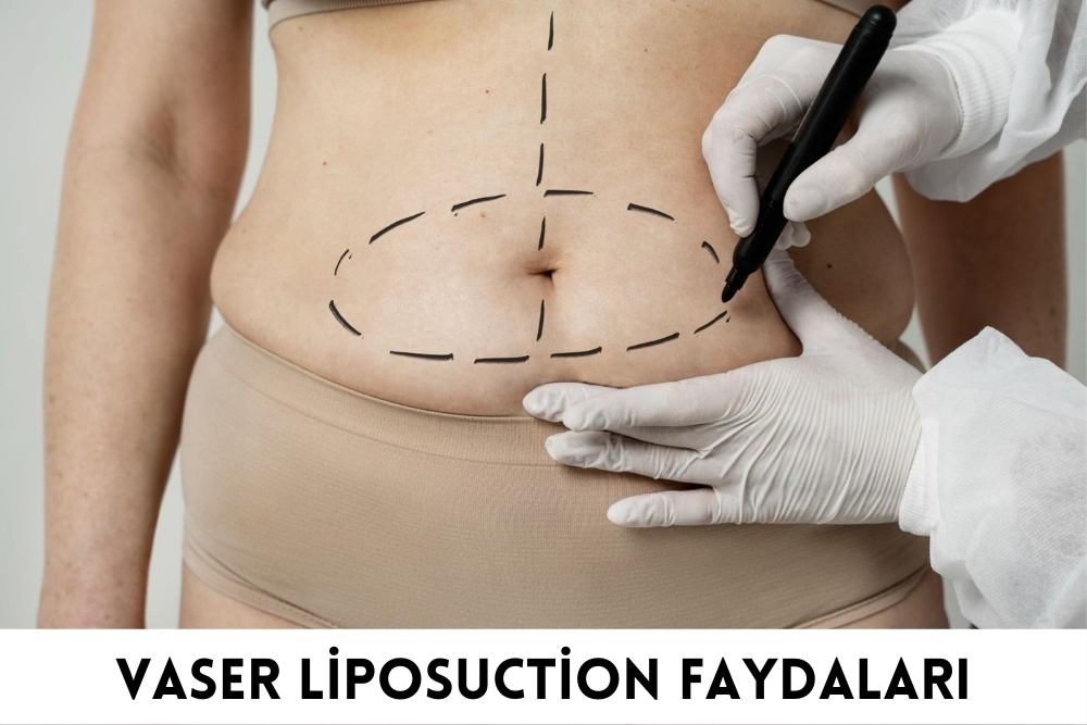 Vaser Liposuction