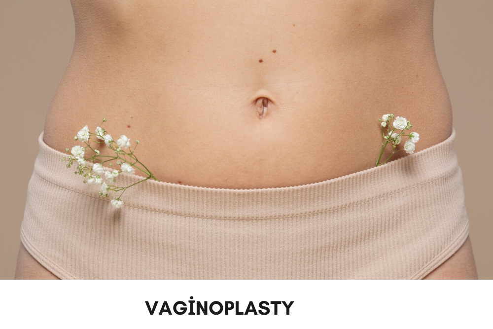 vaginoplasty